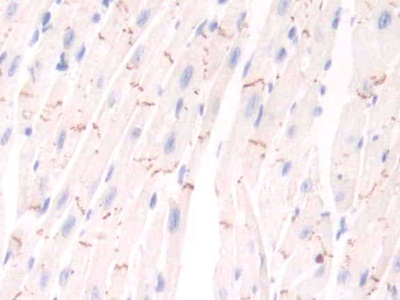 Polyclonal Antibody to Pim-1 Oncogene (PIM1)