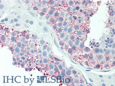 Polyclonal Antibody to Urocortin 2 (UCN2)