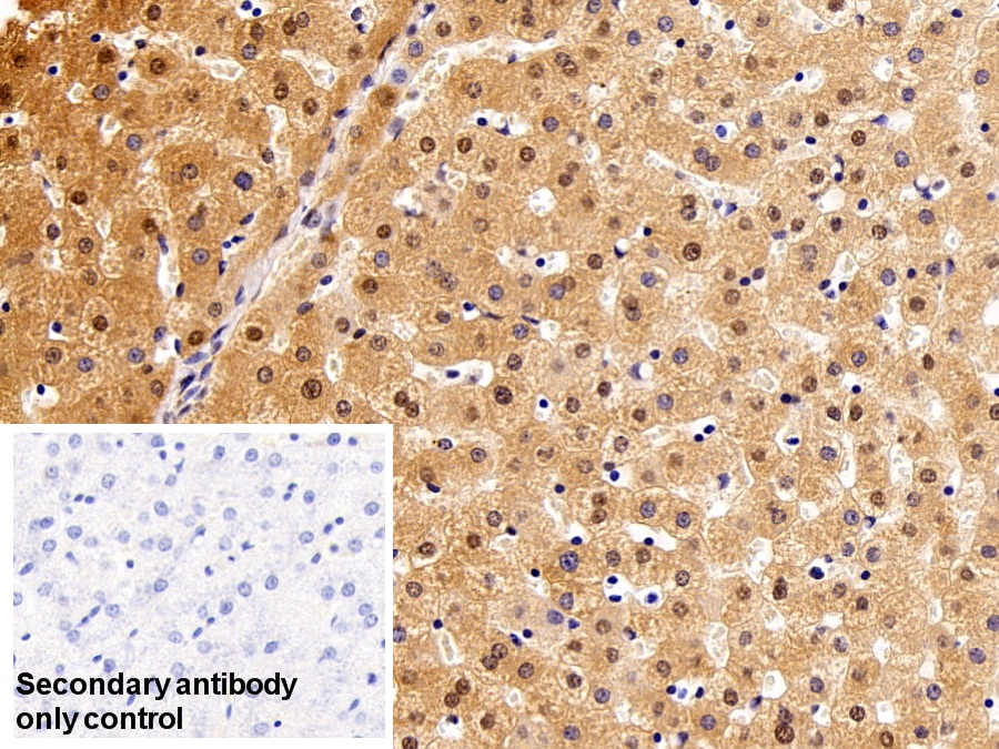 Polyclonal Antibody to Valosin Containing Protein (VCP)