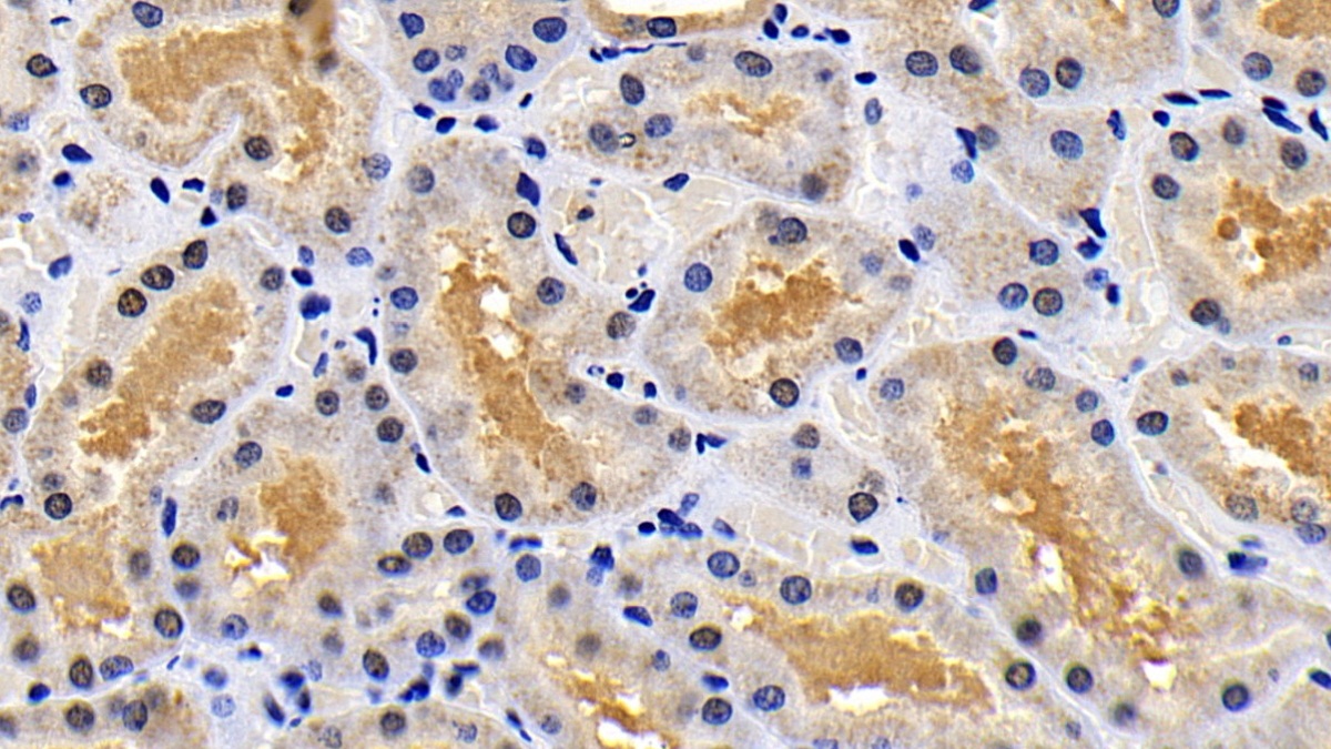 Polyclonal Antibody to X-linked Inhibitor Of Apoptosis Protein (XIAP)