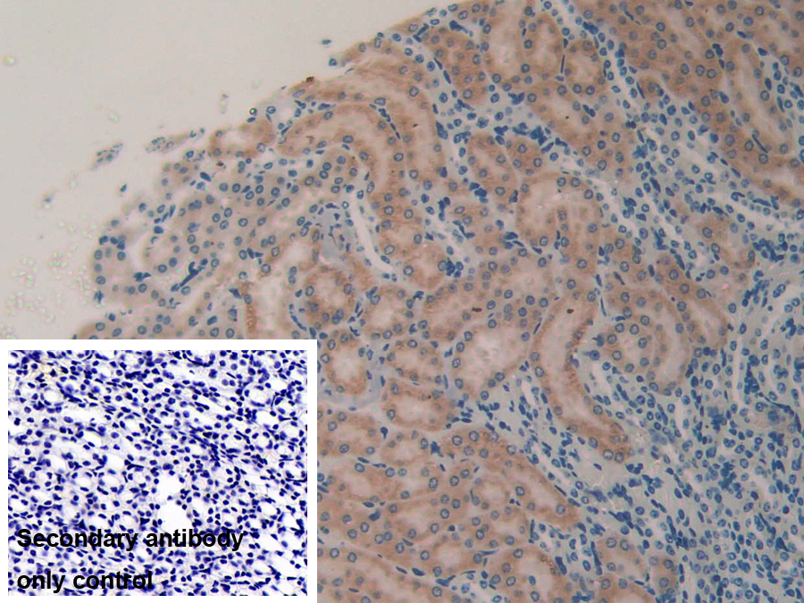 Polyclonal Antibody to Microfibrillar Associated Protein 2 (MFAP2)