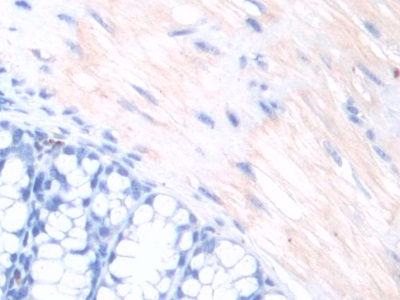 Polyclonal Antibody to Midline 1 (MID1)