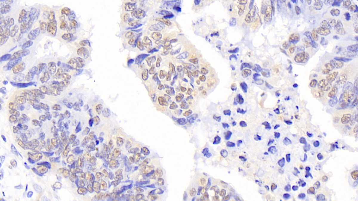 Polyclonal Antibody to Nucleophosmin 1 (NPM1)