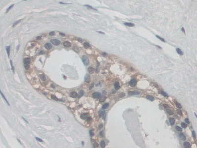 Polyclonal Antibody to Protein O-Mannosyltransferase 1 (POMT1)