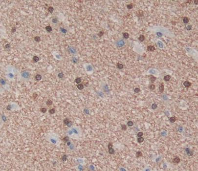 Polyclonal Antibody to Poly U Binding Splicing Factor 60kDa (PUF60)