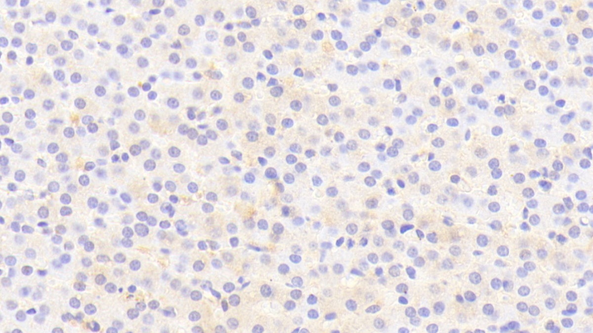 Polyclonal Antibody to Thyroid Hormone Responsive (THRSP)