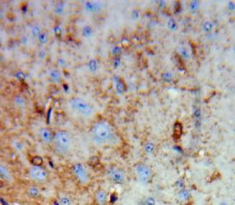 Polyclonal Antibody to Renalase (RNLS)