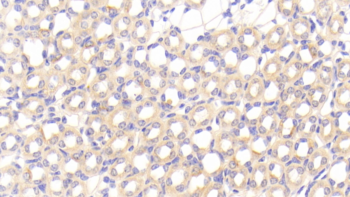 Polyclonal Antibody to Platelet Derived Growth Factor C (PDGFC)