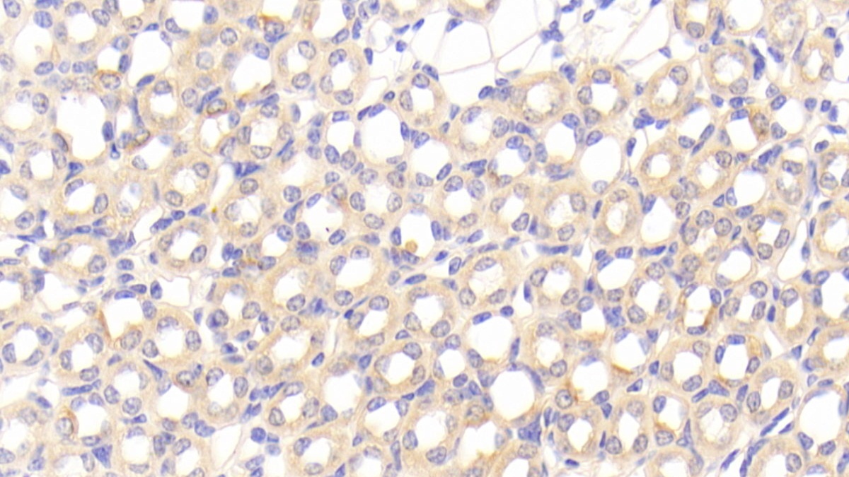 Polyclonal Antibody to Platelet Derived Growth Factor C (PDGFC)