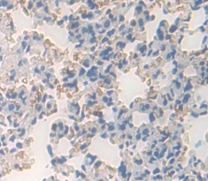 Polyclonal Antibody to Platelet Derived Growth Factor Receptor Like Protein (PDGFRL)