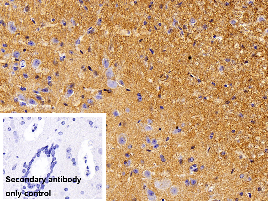 Polyclonal Antibody to Synaptosomal Associated Protein 25kDa (SNAP25)