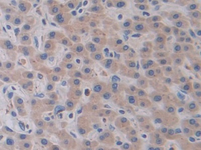 Polyclonal Antibody to Cathepsin V (CTSV)