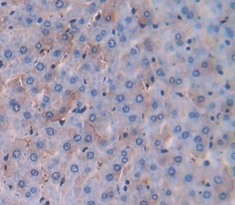 Polyclonal Antibody to Carcinoembryonic Antigen Related Cell Adhesion Molecule 3 (CEACAM3)