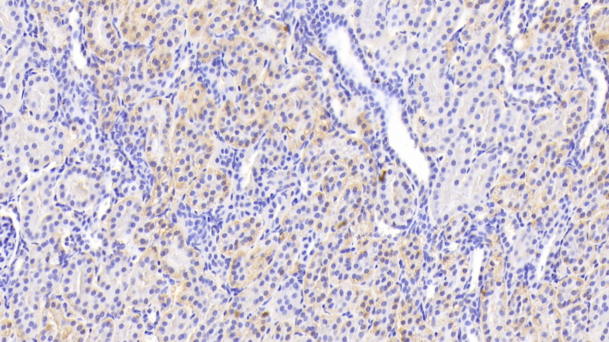 Polyclonal Antibody to Valyl tRNA Synthetase (VARS)