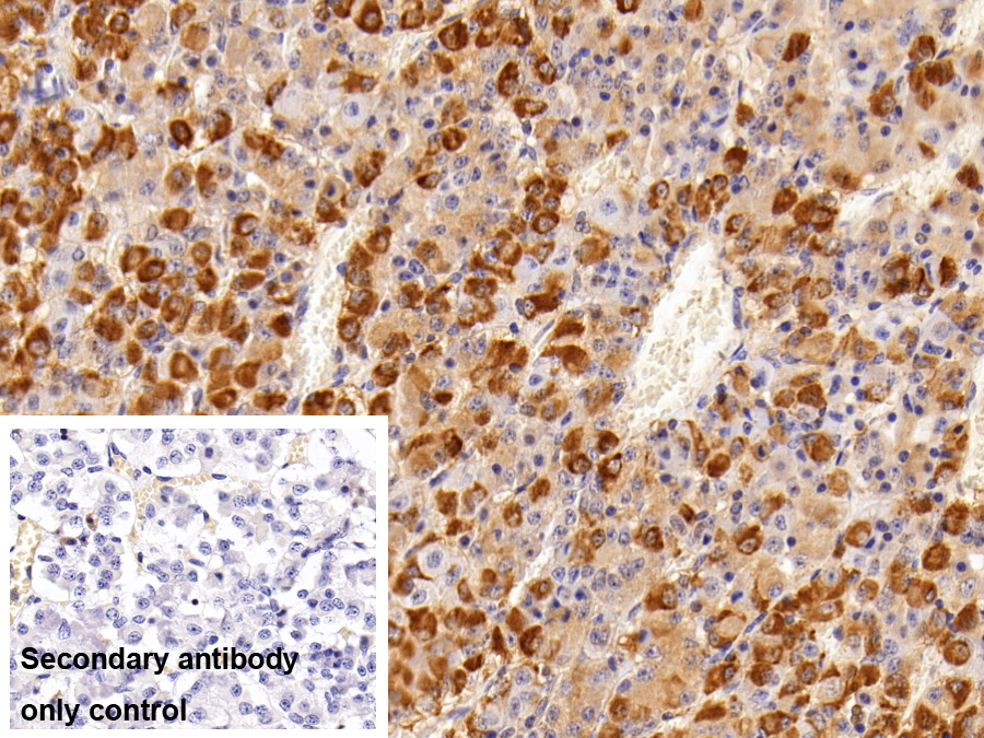 Polyclonal Antibody to Follicle Stimulating Hormone Beta (FSHb)