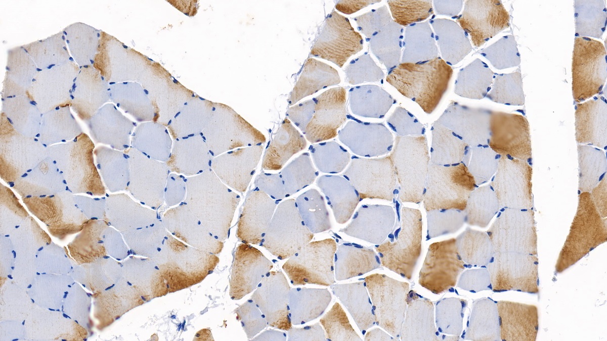 Polyclonal Antibody to Neuropilin 2 (NRP2)