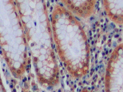 Polyclonal Antibody to Carbonic Anhydrase IX (CA9)