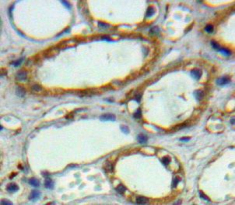 Polyclonal Antibody to Carbonic Anhydrase XII (CA12)