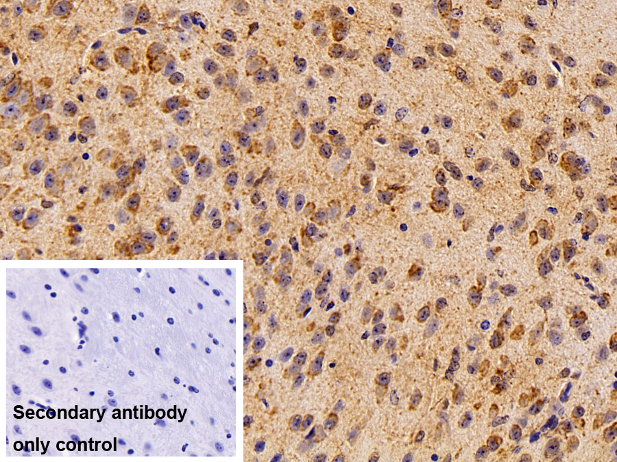 Polyclonal Antibody to Low Density Lipoprotein Receptor Related Protein Associated Protein 1 (LRPAP1)