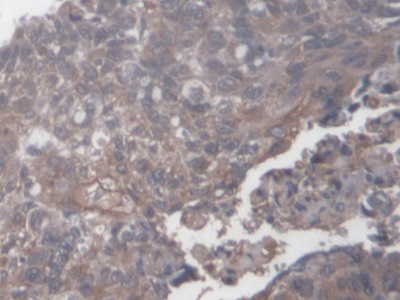 Polyclonal Antibody to Antigen Peptide Transporter 1 (TAP1)