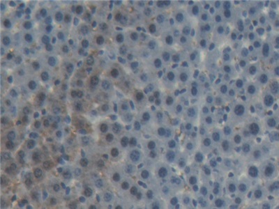 Polyclonal Antibody to Nucleobindin 1 (NUCB1)