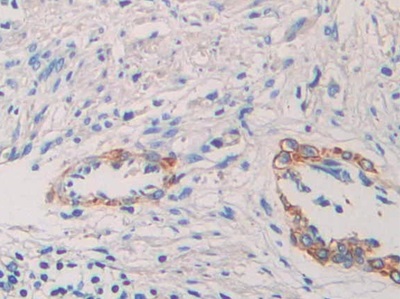 Polyclonal Antibody to Nucleobindin 2 (NUCB2)