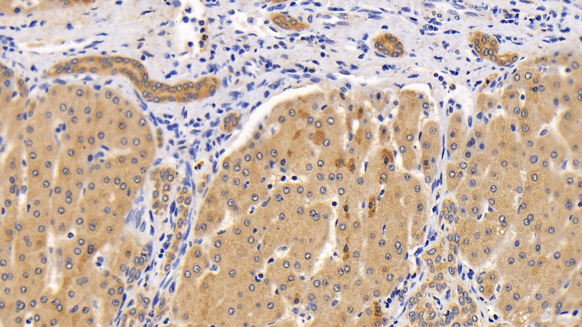 Polyclonal Antibody to Sequestosome 1 (SQSTM1)