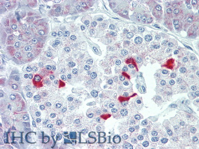 Polyclonal Antibody to Thyroid Stimulating Hormone Beta (TSHb)