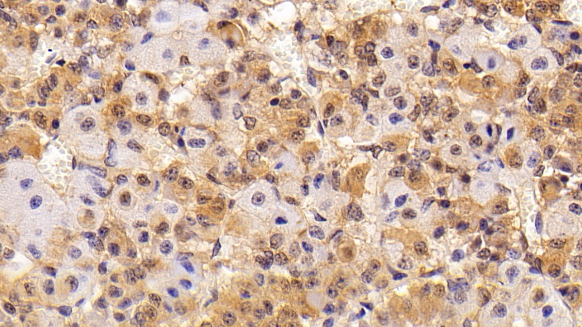 Polyclonal Antibody to Thyroid Stimulating Hormone Beta (TSHb)