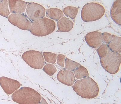 Polyclonal Antibody to Troponin I Type 1, Slow Skeletal (TNNI1)