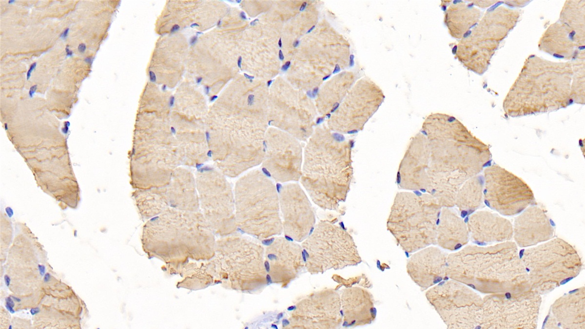 Polyclonal Antibody to Troponin I Type 2, Fast Skeletal (TNNI2)
