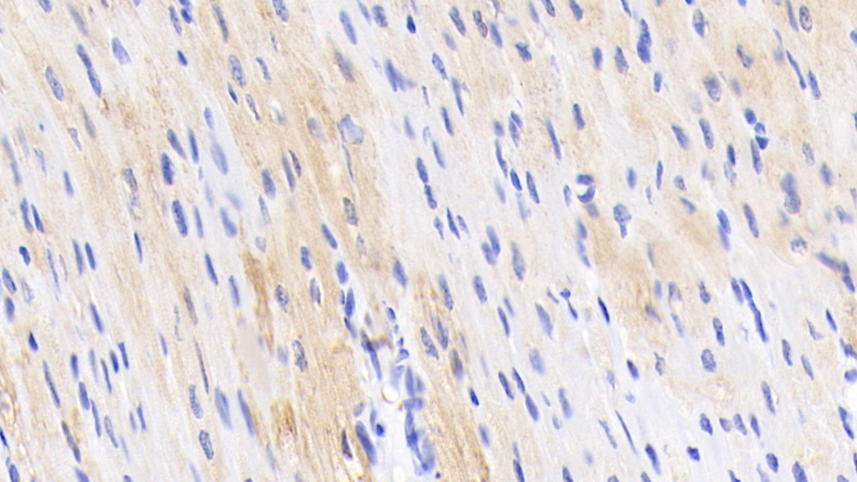 Polyclonal Antibody to Troponin T Type 2, Cardiac (TNNT2)