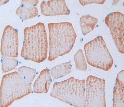 Polyclonal Antibody to Troponin T Type 2, Cardiac (TNNT2)