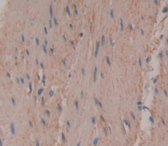 Polyclonal Antibody to Troponin T Type 3, Fast Skeletal (TNNT3)