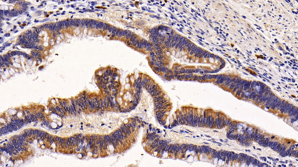 Polyclonal Antibody to Keratin 6A (KRT6A)