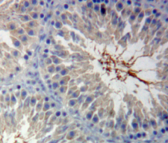 Polyclonal Antibody to Calmodulin 1 (CALM1)