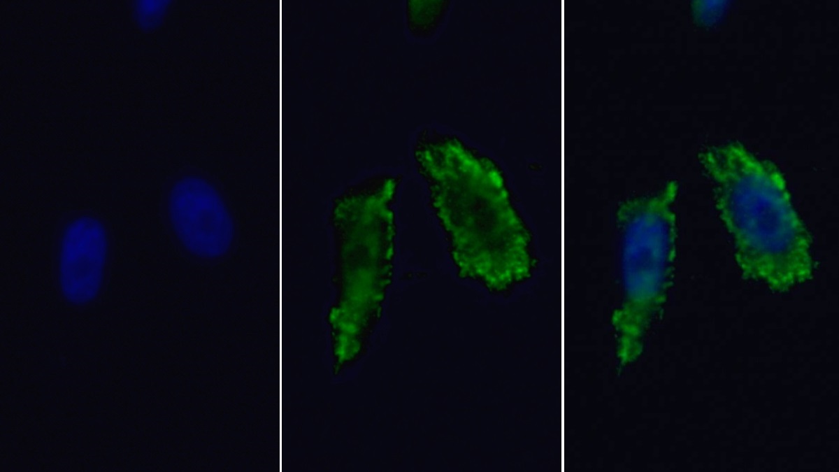 Polyclonal Antibody to Hexokinase 2 (HK2)