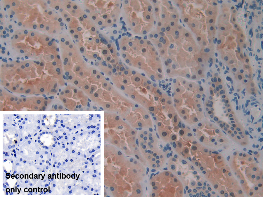 Polyclonal Antibody to Placental Thrombin Inhibitor (PTI)