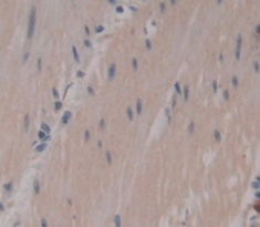 Polyclonal Antibody to Myosin Heavy Chain 7, Cardiac Muscle, Beta (MYH7)