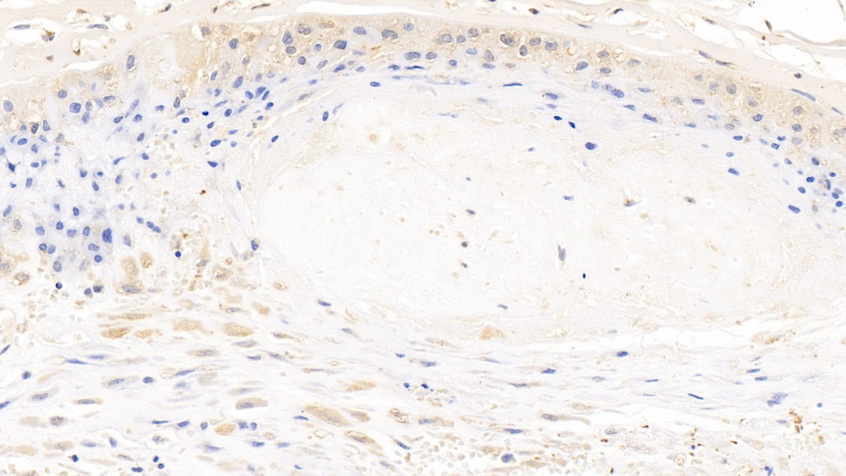 Polyclonal Antibody to Myosin Heavy Chain 9, Non Muscle (MYH9)