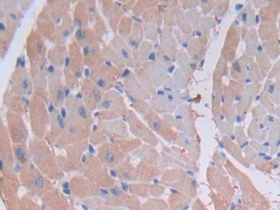 Polyclonal Antibody to Myosin Light Chain Kinase 2 (MYLK2)