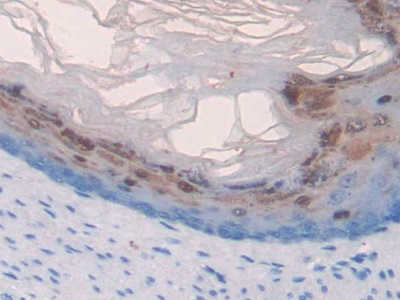 Polyclonal Antibody to Myosin IB (MYO1B)