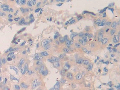 Polyclonal Antibody to Myosin IC (MYO1C)
