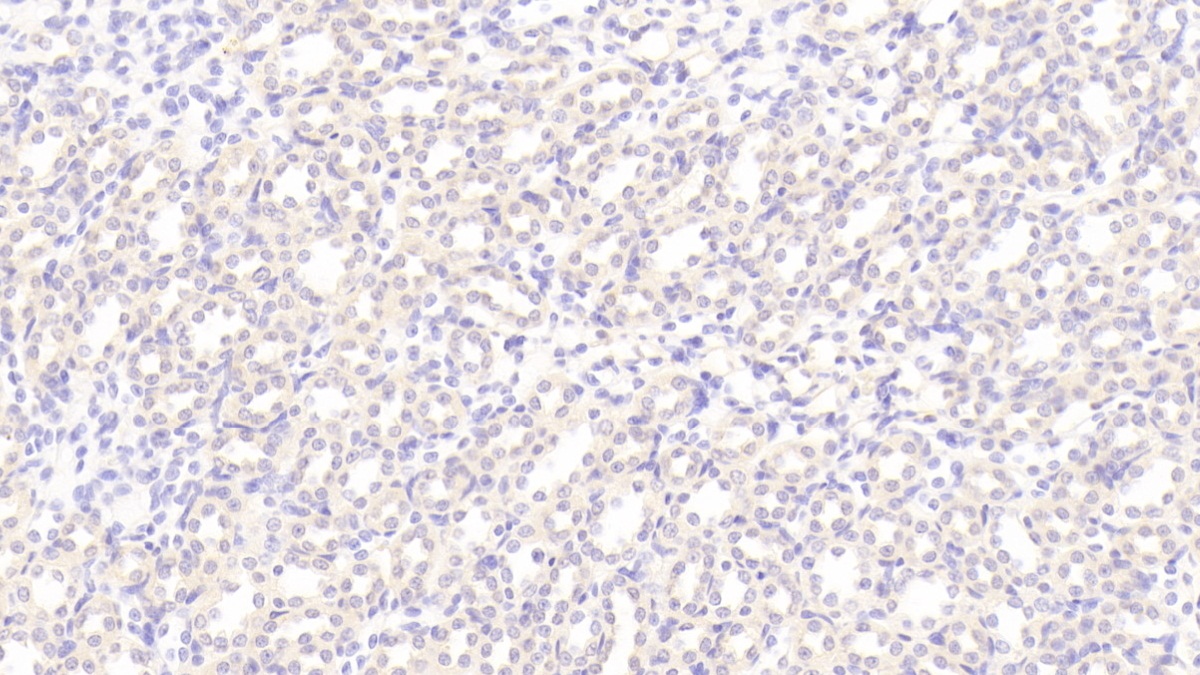 Polyclonal Antibody to Myosin IC (MYO1C)