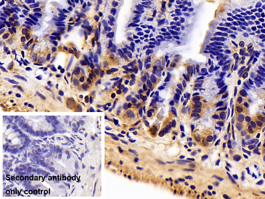 Polyclonal Antibody to Myosin IE (MYO1E)