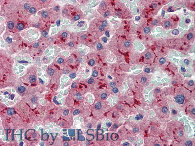 Polyclonal Antibody to ATP Binding Cassette Transporter B11 (ABCB11)