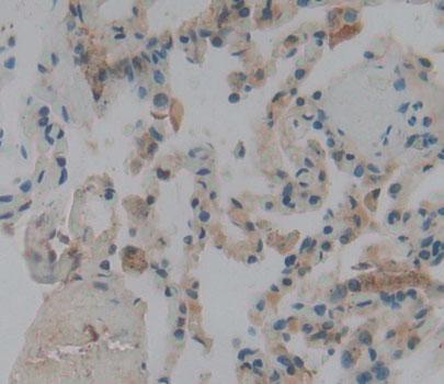 Polyclonal Antibody to Preprooxytocin (OT)