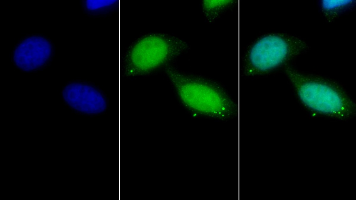 Polyclonal Antibody to High Mobility Group Box Protein 3 (HMGB3)