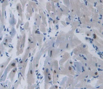 Polyclonal Antibody to Topoisomerase III Beta (TOP3b)