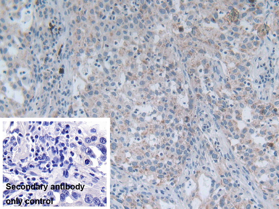 Polyclonal Antibody to Ornithine Aminotransferase (OAT)